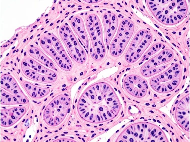 Esempio biopsia duodenale