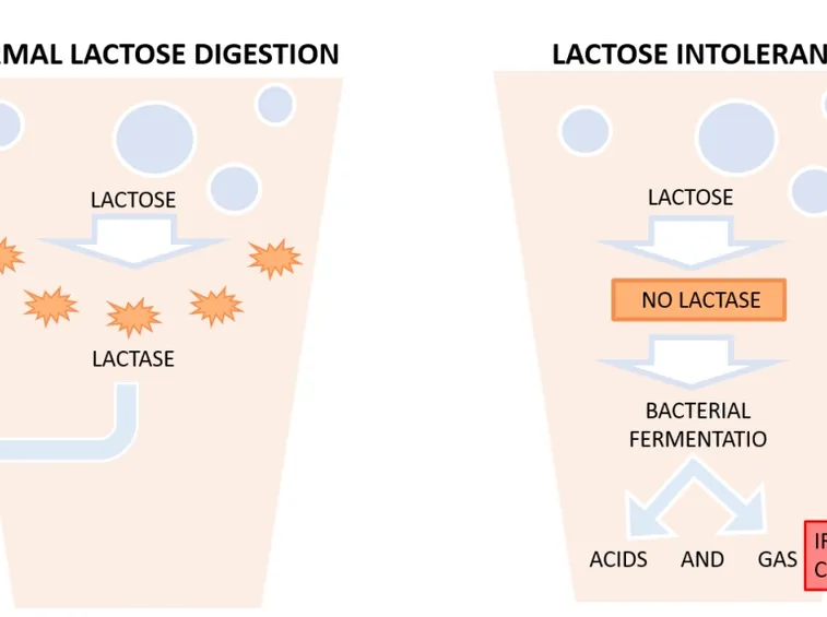 Digestione del lattosio