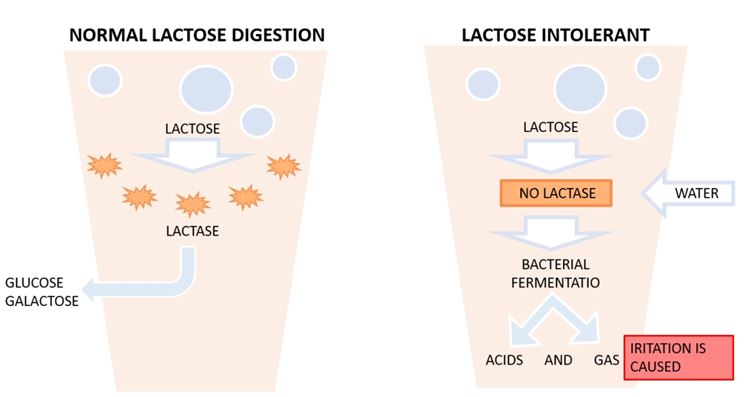 Metabolismo intollerante lattosio